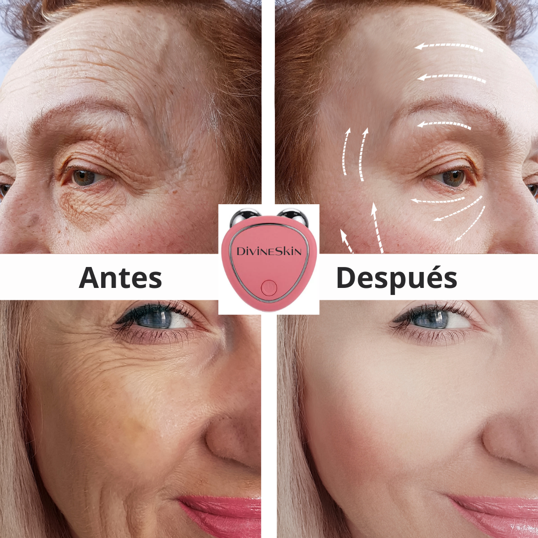 TENDENCIA!!! Dispositivo de Rejuvenecimiento Facial DivineSkin™🪷🪞